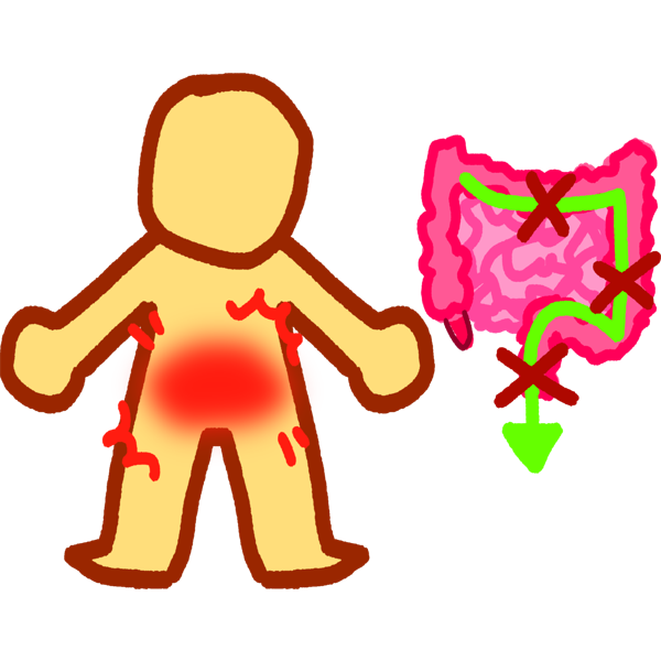 an emoji-yellow person with a splotch of red over their lower abdomen and little lines radiating out from it. beside them is a drawing of intestines. there's a green arrow that goes along the large intestine and out through the colon, with red X's along the way.
